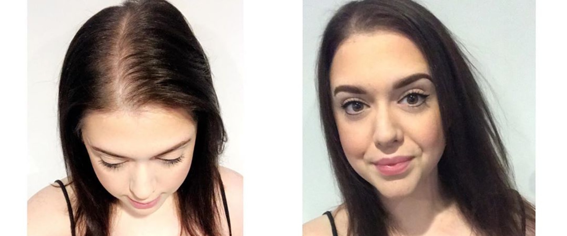 Hairstyles for Thinning Hair: Tips and Tricks for Preventing and Managing Hair Loss