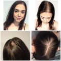 Hairstyles for Thinning Hair: Tips and Tricks for Preventing and Managing Hair Loss