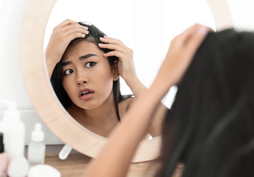 Stress and Hair Loss: Understanding the Causes and Finding Solutions